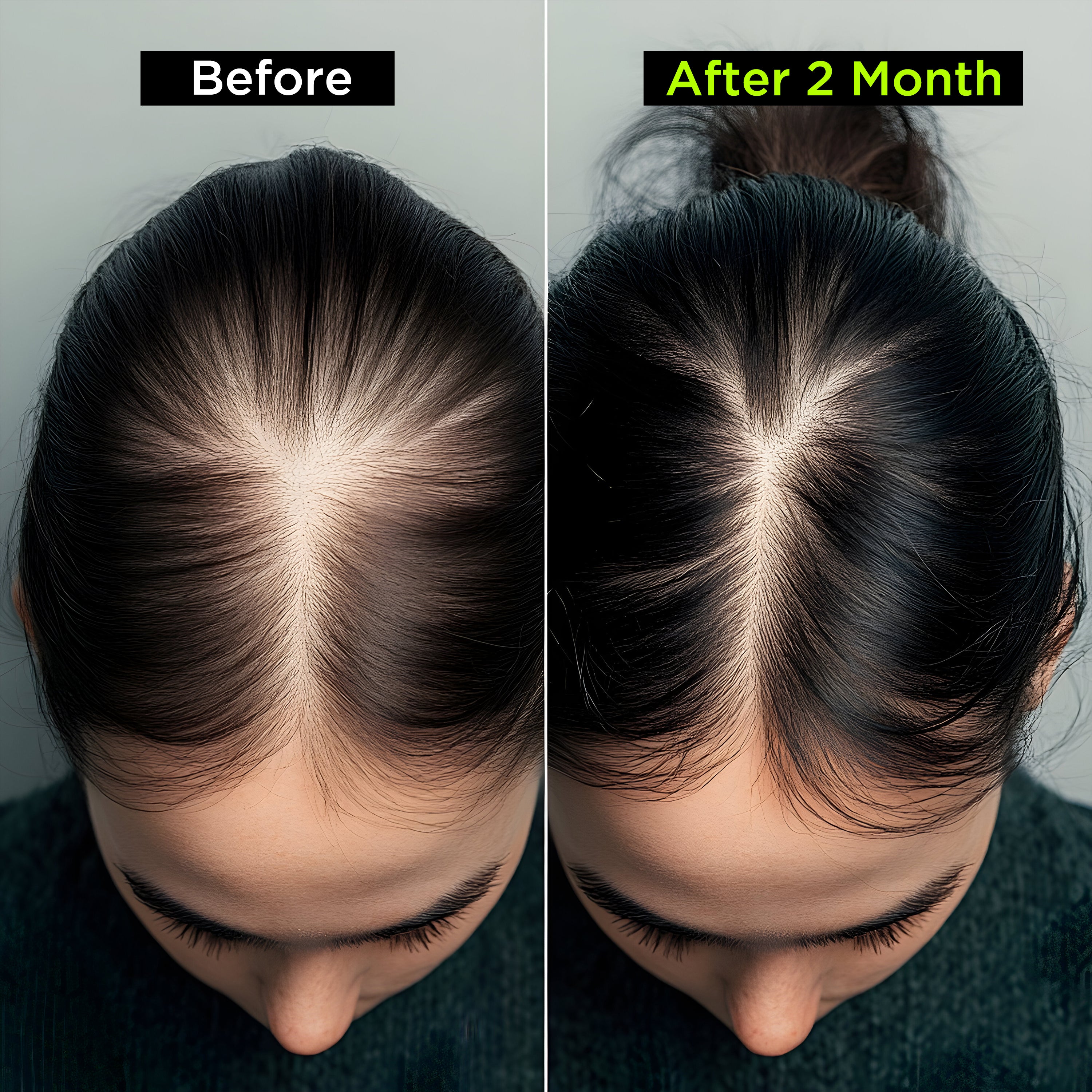 Health Veda Organics Advance Hair Vitamin with DHT Blocker & Biotin | Clinically proven Hair Vitamins For Men & Women - 60 Veg Capsules