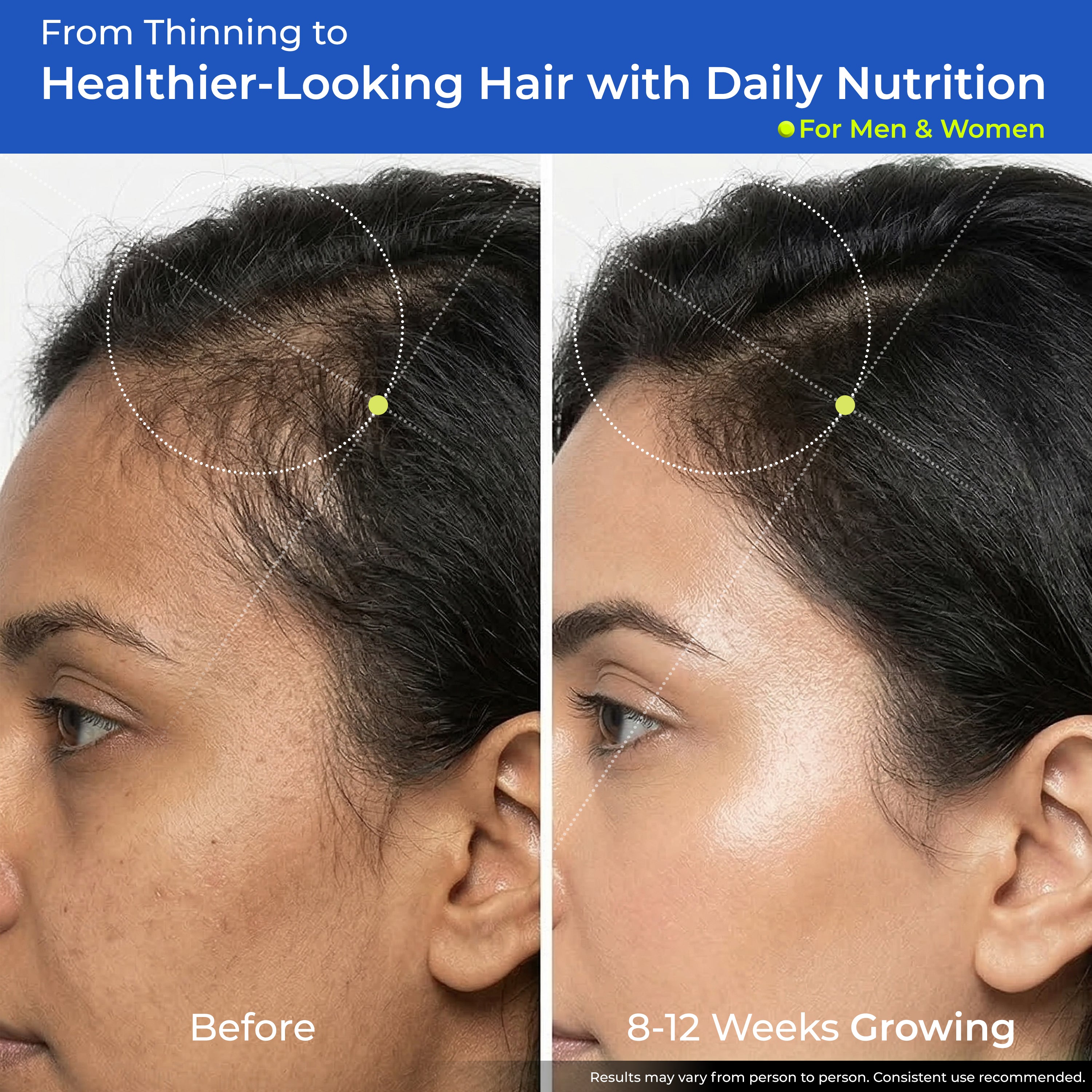 Health Veda Organics Biotin Tablets for Hair Growth | Biotin Supplement 10000mcg for Men & Women | Supports Hair, Skin & Nails | With Bhringraj, Stinging Nettle, Green Tea, Zinc & Vitamin E | 60 Tablets